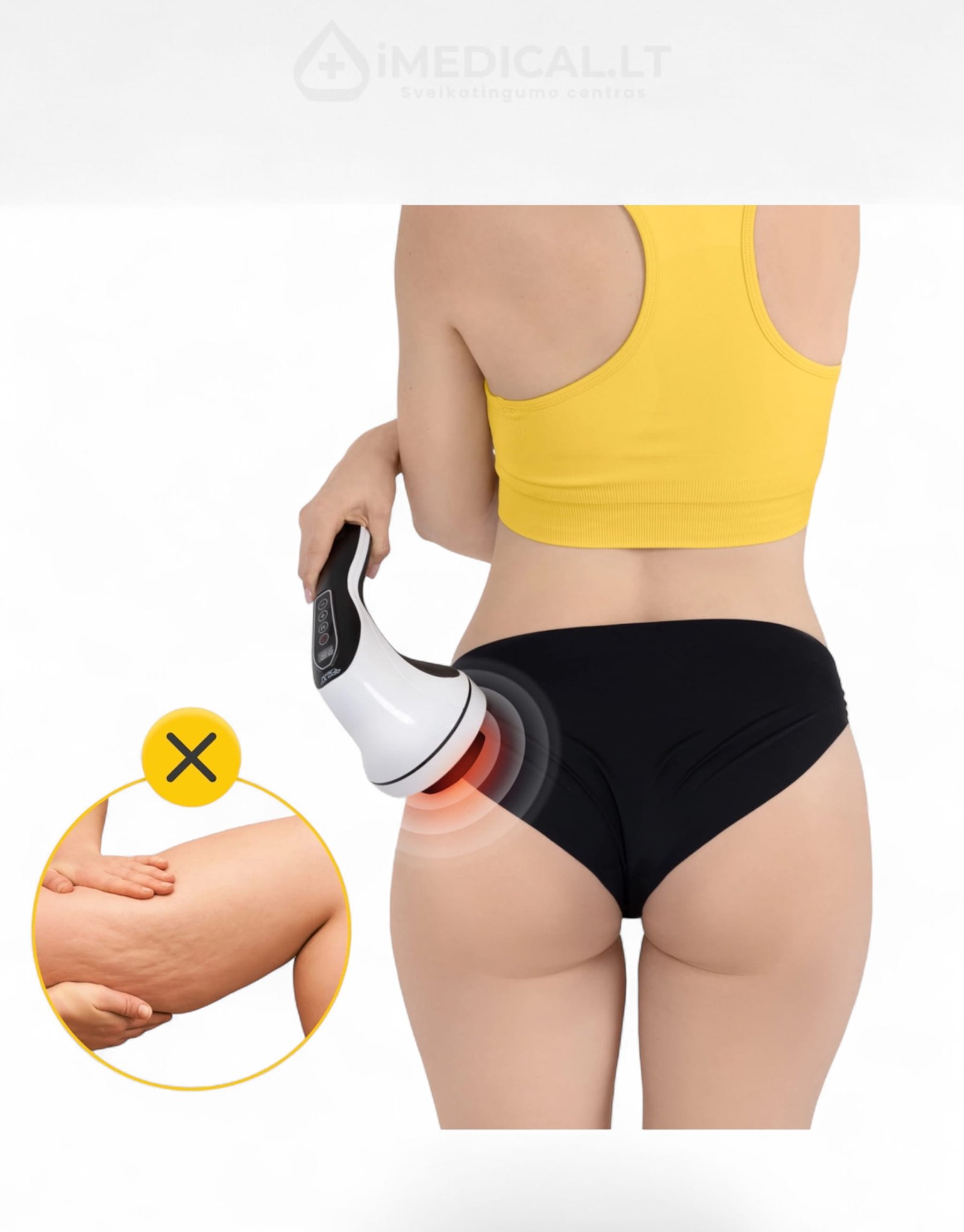 Anticeliulitinis Masažuoklis anticeliulitinis masažuoklis šlaunims